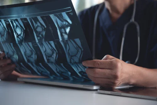 Doctor holding and looking patient bone x-ray film before surgery. MRI and CT scan examining at radiology orthopedic unit in hospital. Knee joint x-ray for treatment